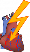 arrhythmia-156099_1280.png